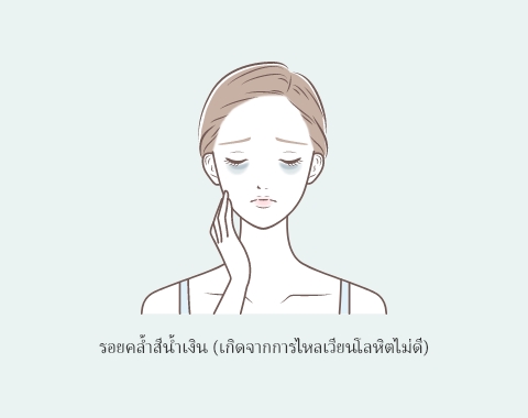 รอยคล้ำสีน้ำเงิน ①: ผิวบางลง