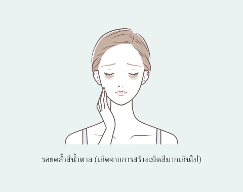 รอยคล้ำสีน้ำตาล: การสร้างเม็ดสีมากเกินไป