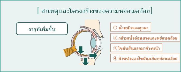 รอยคล้ำสีดำ (รอยคล้ำเงา): ความหย่อนคล้อย